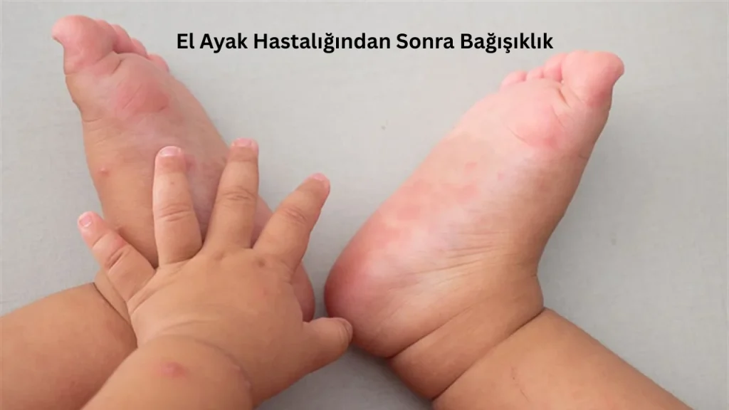 El Ayak Hastalığından Sonra Bağışıklık